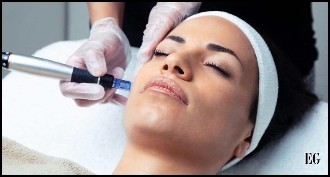 Esteticista profesional realizando un tratamiento de microneedling con dermapen en una cliente relajada, enfocado en la rejuvenecíon de la piel facial en un entorno clínico.